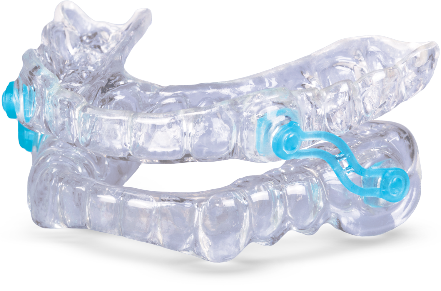 Custom clear oral appliance with blue connector hardware for sleep apnea therapy